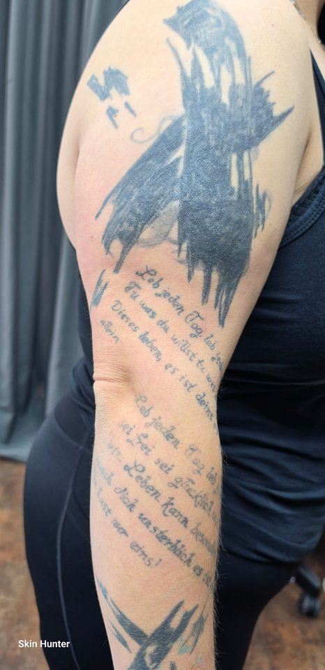 Vorher: Arm mit alten Schriftzügen und dunkler Fläche vor dem Cover-Up